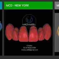 MCD 2025 – 14 Premium Dental Libraries for Exocad + Installation Guide