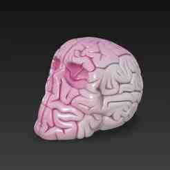 Skull Brain
