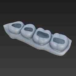 practice models for dental impressions